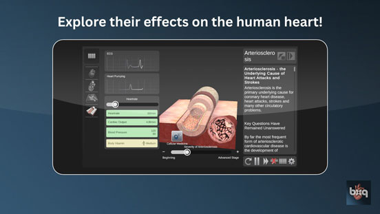 bodyxq Gesundheits-App zur Visualisierung von Arteriosklerose bodyxq Gesundheits-App zur Visualisierung von Arteriosklerose