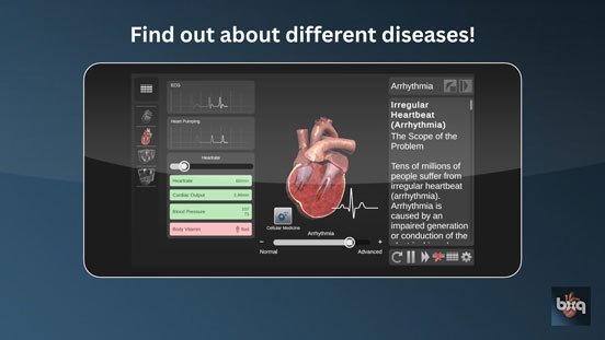 bodyxq Gesundheits-App zur Visualisierung von Herzrhythmusstörungen bodyxq Gesundheits-App zur Visualisierung von Herzrhythmusstörungen